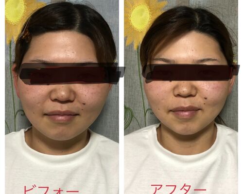 4E766CE1-467F-4A10-BF33-995B4F2C637C