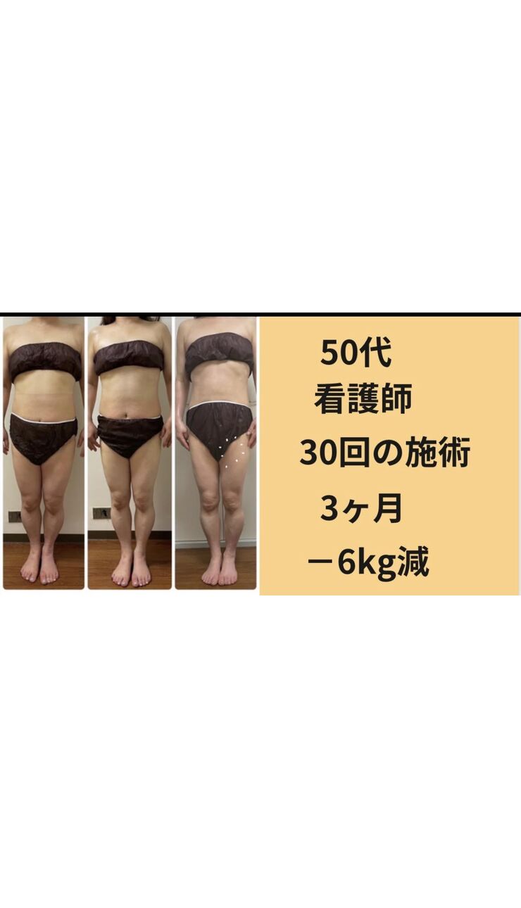 50代看護師30回－６kg